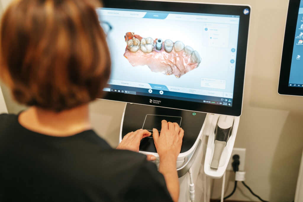 Dental professional reviewing 3D dental implant image on monitor